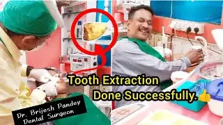 No pain .Tooth extraction done successfully.