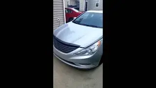 Sonata High Pressure Fuel Line