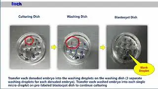 niPGT-A: The Game-Changing Embryo Test That Doesn't Touch the Embryo