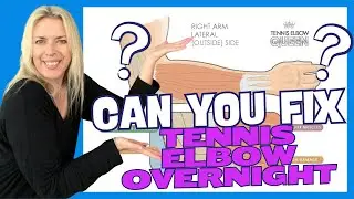 Can You Fix Tennis Elbow Overnight? Here's the Truth!