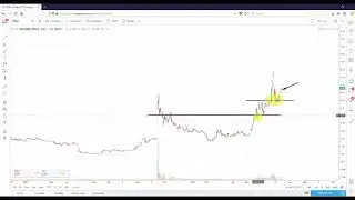 TransEnterix, Inc. (TRXC)- Technical Analysis