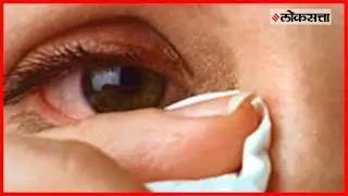 How to Remove Dust From Eye