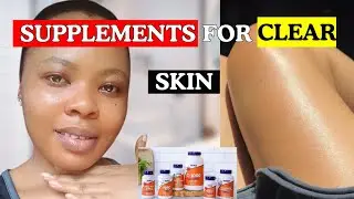 Top 7 Supplements for Glowing Skin Naturally | Vitamin C, Collagen, Glutathione, Biotin & More