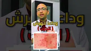 لازم كل البيت ياخد العلاج (الجرب)