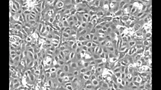 ibidi   cells in focus  HUVEC culture under perfusion vs  static conditions