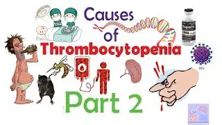 Thrombocytopenia- Interpretation of complete blood count part 2.2 Medicine basics simplified