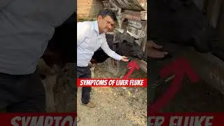 Symptoms of liver fluke l dr Umar khan