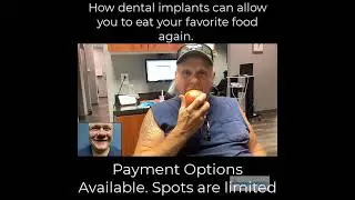 Dental Implants Can help you chew an Apple.
