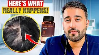 Biotin & Hair Loss &ndash; Here&rsquo;s What Really Happens!