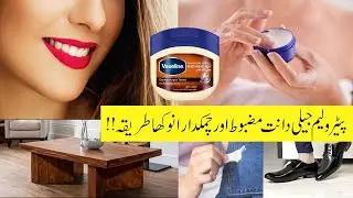 SMART Home Hacks & Zero Cost Useful Kitchen Tips | Kitchen Organization Ideas | Tips And Tricks