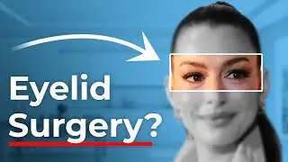 Eyelid Surgeon Reacts to Anne&nbsp;Hathaway&nbsp;Transformation