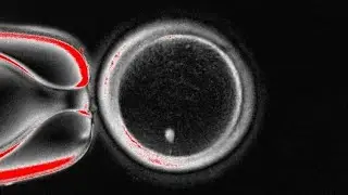 Medical Research News: Gene Editing, Organ on a Chip in Space and More 