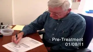 World's first essential tremor patient treated with MR-guided focused ultrasound