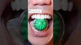 ASMR | Watermelon 🍉 Gummy Ball 🙄 #DoctorTristanPeh
