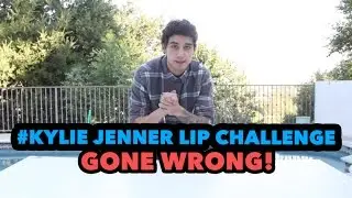 KYLIE JENNER LIP CHALLENGE GONE WRONG!