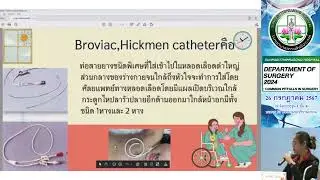 การดูแลสาย Broviac catheter ในผู้ป่วยเด็ก กลุ่ม Short bowel Syndrome โดย พว รัชนี ทองคำ
