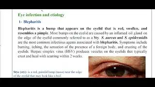Lecture 25 part 1 Bacterial infections of eyes, ears,