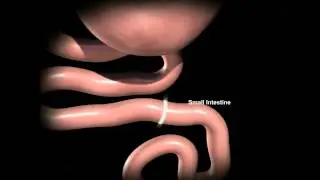Fairfield Medical Center offers gastric bypass surgery
