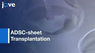 ADSC-sheet Transplantation for Esophageal ESD Stricture prevention | Protocol Preview