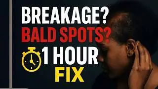 How to Regrow Your Hairline FAST | Natural Hair 1-Hour Tutorial + Live Q&A
