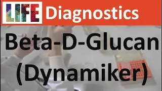 Beta-D-glucan testing (Dynamiker kit)