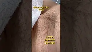 Депіляція глибокого бікіні Харків депиляция глубокое бикини после бритвы