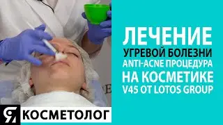Лечение угревой болезни. Anti-acne процедура на косметике V45 от Lotos Group.