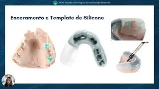(1122932) Abordagem multidisciplinar em pr&oacute;tese fixa: aumento da dimens&atilde;o vertical