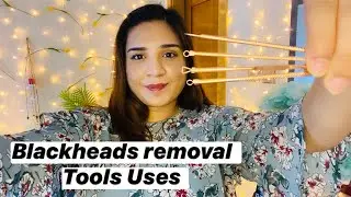 Amazon Blackhead removal tools Uses and review || Blackhead removal on face at home