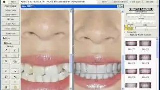 SNAP Dental Cosmetic Imaging Software