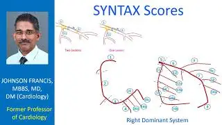 SYNTAX Scores