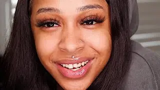 STORY TIME: my ex broke my tooth. LOL.