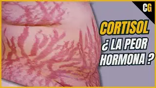 Cortisol - &iquest;La PEOR Hormona de Todas? - S&iacute;ndrome de CUSHING y Efectos del CORTISOL- Estr&eacute;s 2/2