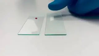 How to make a blood smear
