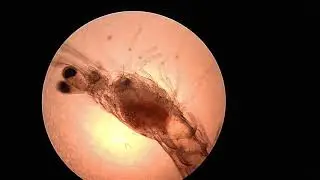 Analisis de post larva - litopenaeus vannamei