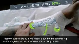 Practical use VOKA.IO (17.07.PI) - computer vision system for trauma surgeries