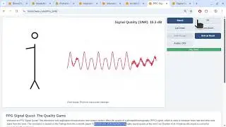 Simulating PPG Signal Quality: The Impact of Body Posture