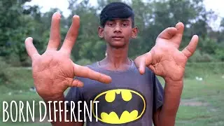 The Teen With The Giant Hands | BORN DIFFERENT