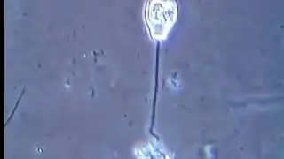 Инфузория Сувойка (Vorticella)