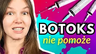 ❓Jak Wygładzam GŁĘBOKIE Zmarszczki Mimiczne u Pacjentów❓