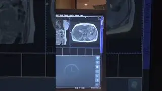 Mrcp / radial sequence set up.