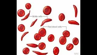 RBC shape function HB characterstic