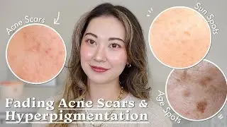 Fading Acne Scars & Hyperpigmentation | Vitamin C Dupes for Sensitive Skin ft. P.CALM