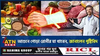 আগুনে পোড়া রোগীর যা খাবেন, জানালেন পুষ্টিবিদ | Burn Recovery | Healthy Eating | Burn Wound Care
