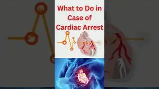 What to Do in case of Cardiac Arrest #cardiacarrest #cpr #apd #cardiac #cardiachealth