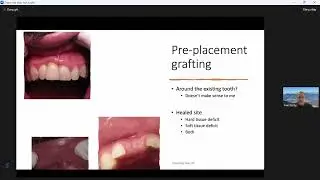 Soft tissue management