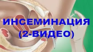 ИНСЕМИНАЦИЯ ҲАҚИДА 2-ВИДЕО