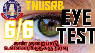 TNUSRB-EYE TEST| medical eye details