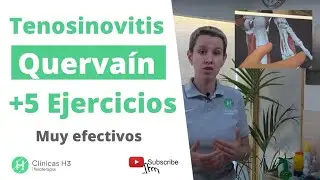 Tendinitis de De Quervain - Tratamiento con 5 ejercicios MUY EFECTIVOS ✅ Clínicas H3