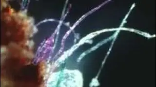 (MUST WATCH) Morgellons disease is real, moving fibers nanotechnology this is not static electricity